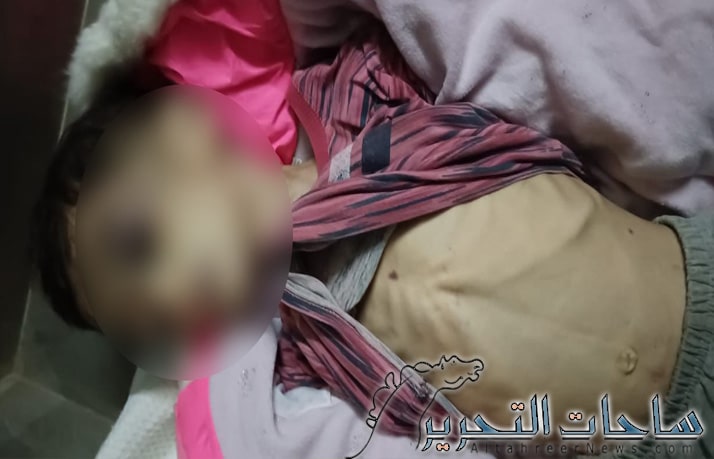 بسبب التعنيف الاسري .. وفاة طفلة في بغداد